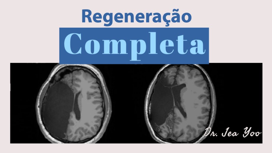 Regeneração Completa - Dr. Jea Myung Yoo